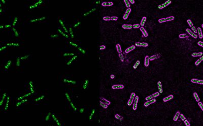 Glowing proteins give York researchers new key insights into cellular components